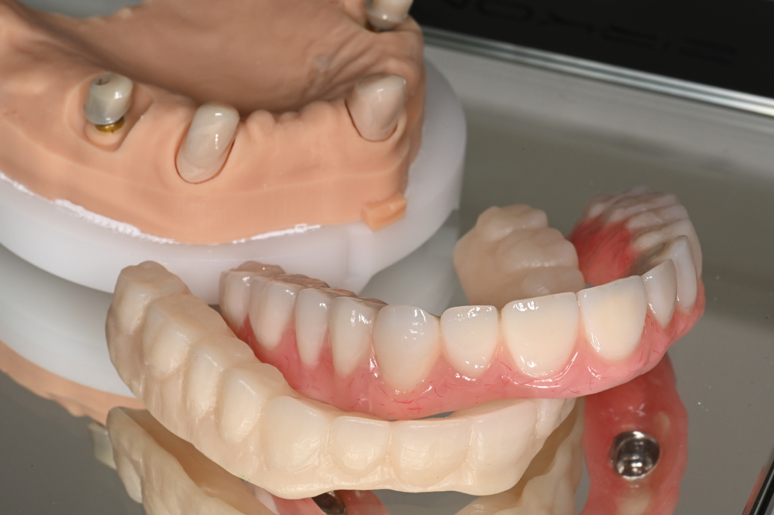 Teleskoptechnik & Kombiarbeiten